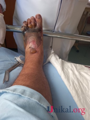 "HB Güvən" klinikasının professoru qazinin ayağını görün nə hala saldı- FOTOLAR