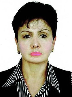 Xalq artisti dərs zamanı yıxıldı,qolu sındı - FOTO