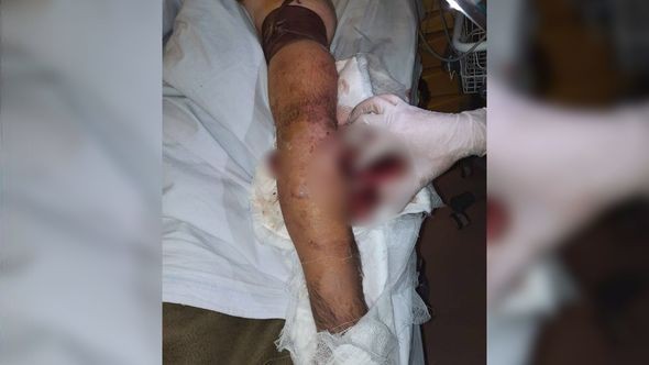 Ermənilərin yaraladığı şəxslə bağlıRƏSMİ AÇIQLAMA - YENİLƏNİB (FOTOLAR)