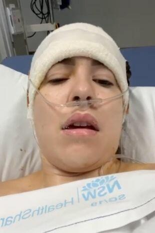 Beyin əməliyyatından çıxan kimi çılpaq şəkillərini paylaşdı- FOTOLAR