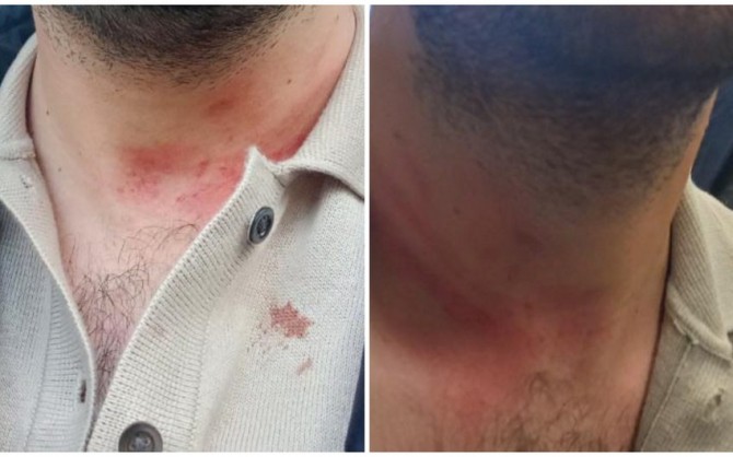 Azərbaycanda vəzifəli şəxs iş vaxtı kabinetində döyülüb- FOTO