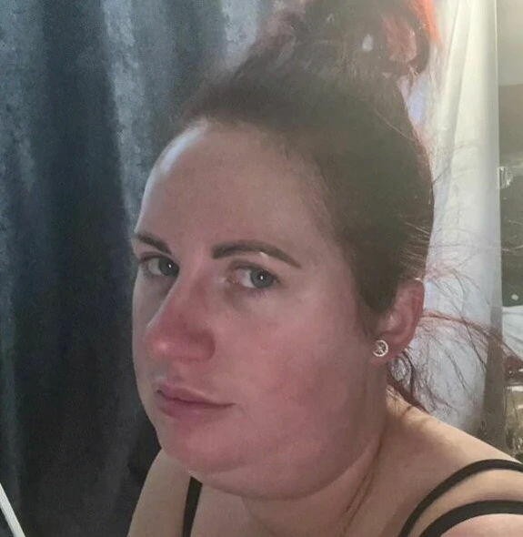 Buxağını kiçiltmək istədi, üzü dörd dəfə böyüdü- FOTOLAR