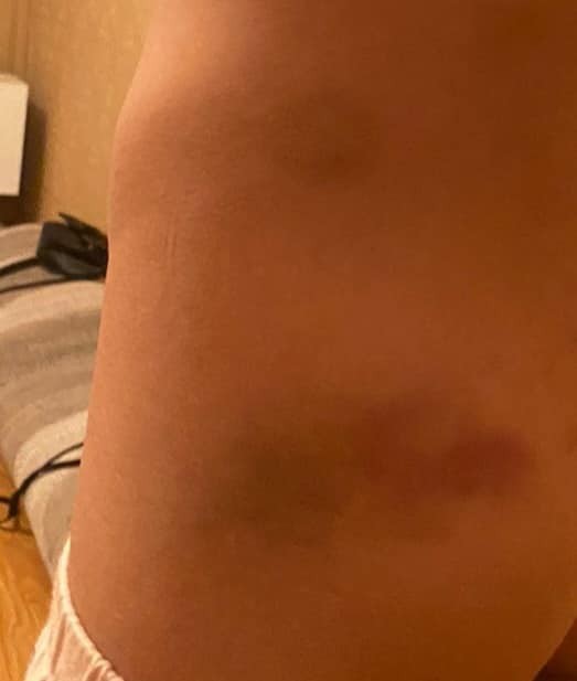 Azərbaycanda iki qadını döyüb evdən qovdular- FOTOLAR