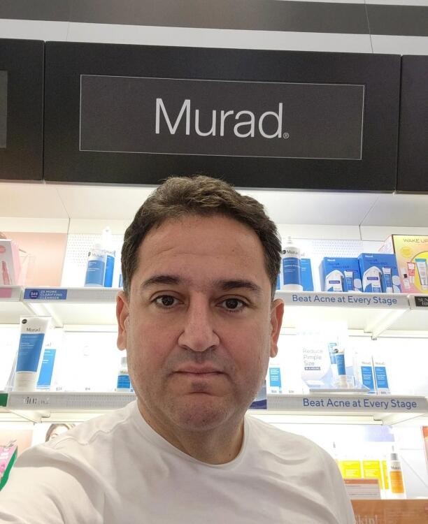 Murad Dadaşov tanınmaz dərəcədə dəyişdi- FOTO