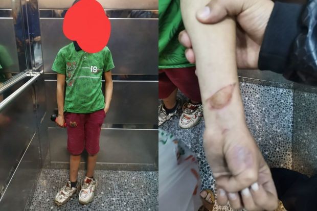 Xırdalanda DƏHŞƏT:Uşağın qolunu yandırıb küçəyə atdılar (YENİLƏNİB)