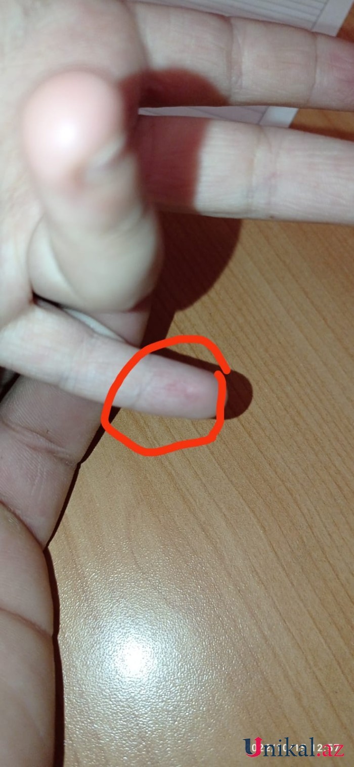 Azərbaycanda bu məktəbdə tükürpədici olay:İki azyaşlı şagirdə iynə vururmuşlar (ŞOK İDDİA)