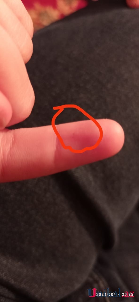 Azərbaycanda bu məktəbdə tükürpədici olay:İki azyaşlı şagirdə iynə vururmuşlar (ŞOK İDDİA)