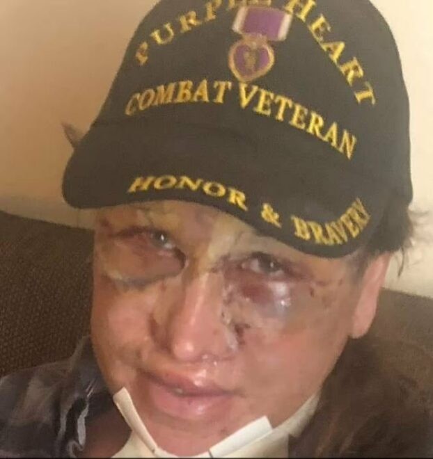 Cinsiyyət dəyişdirən hərbçi peşimandır:Yenidən kişi olmaq istəyir