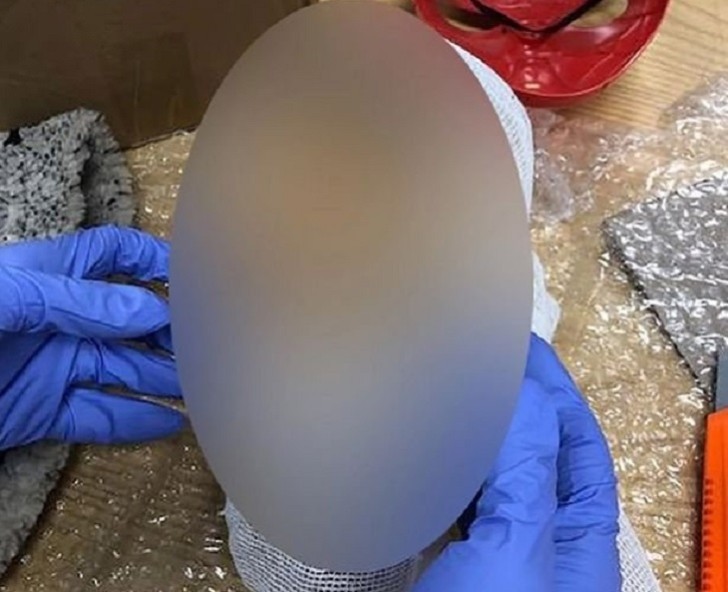 DƏHŞƏT: Gömrükdə bağlamadan kəsilmiş uşaq başı çıxdı -FOTO