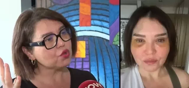 Tanınmış jurnalist estetik əməliyyat olundu -Görmə qabiliyyətini itirdi