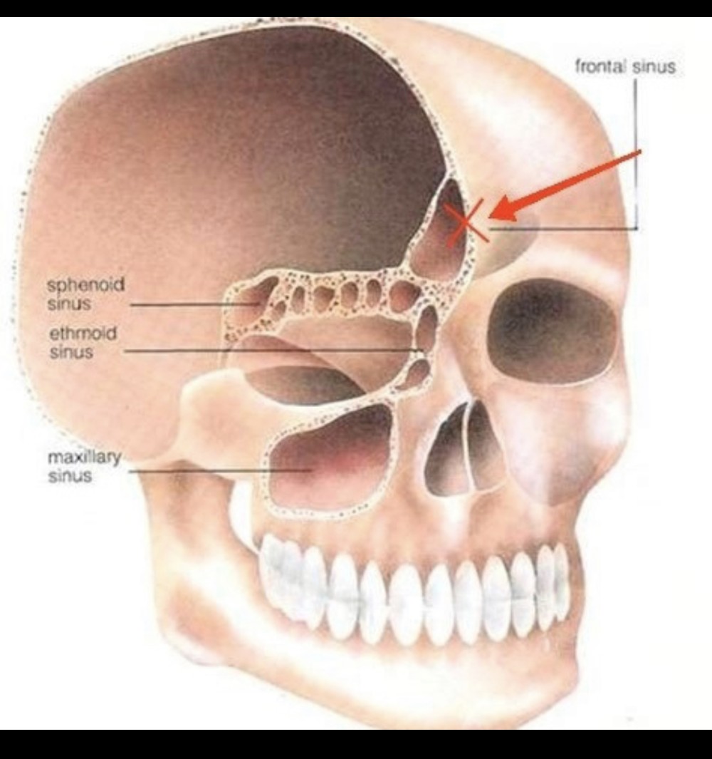 “Mercedes”in sürücüsü məşhur aktyorun kəlləsini sındırıb