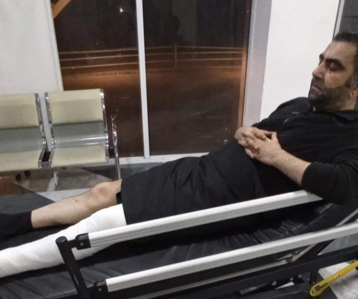 Azərbaycanda tanınmış şairi motosiklet vurdu: Ciddi xəsarət aldı - Foto