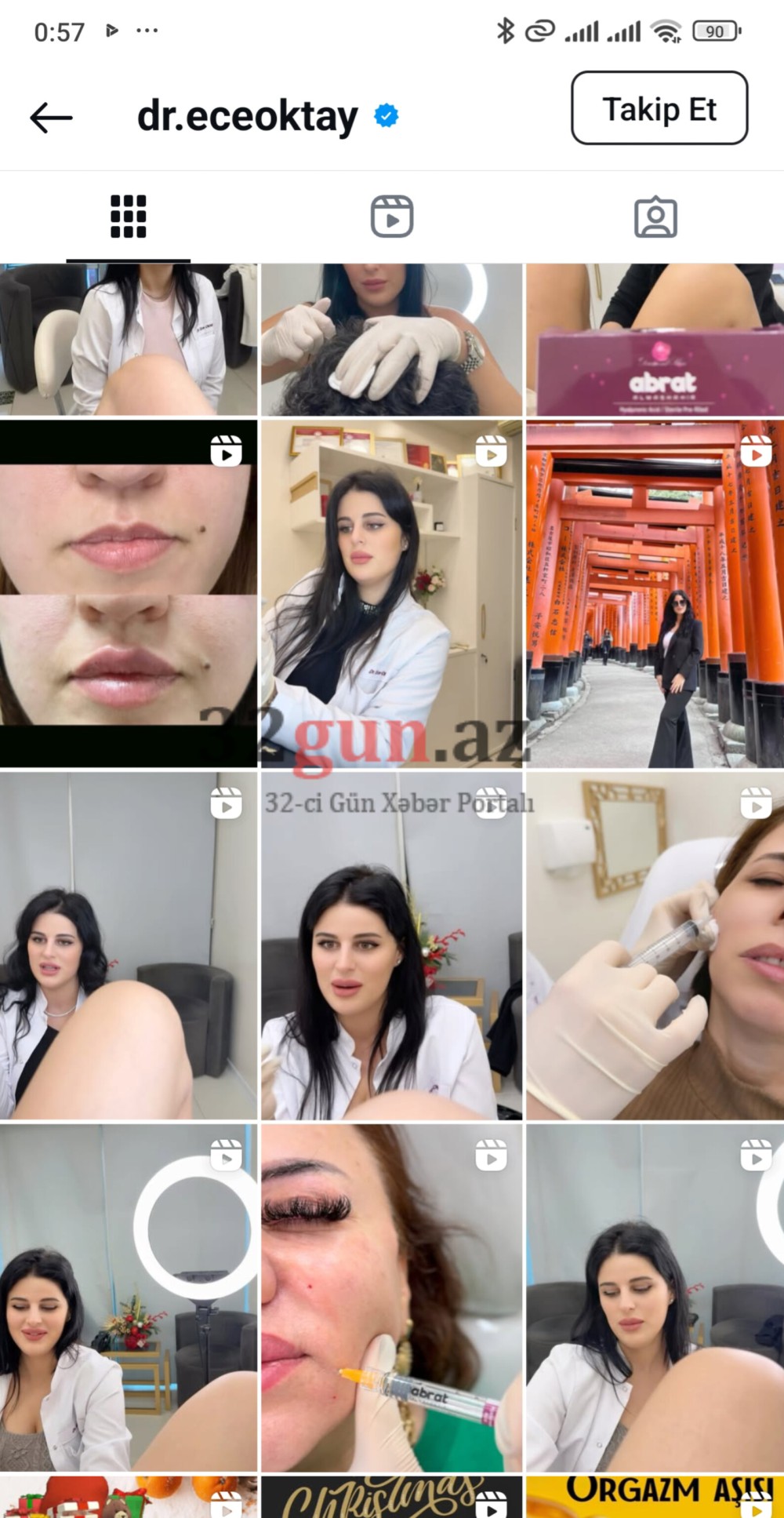 “Laser Beauty Clinic”in  bağlanan filialından YENİ BİABIRÇI GÖRÜNTÜLƏR:Türkiyəli həkim görün nə paylaşıb / FOTO