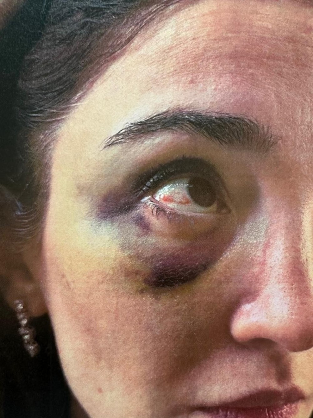 Məzahir Pənahovun oğlu arvadına işgəncə verib- FOTO