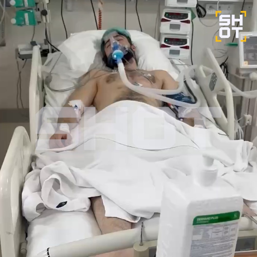 Türkiyədə otelin estakadasından suya tullanaraq ağır xəsarət alan rusiyalı turist komaya düşüb