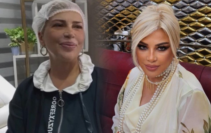 Mətanət İsgəndərlinin plastik əməliyyatdan sonrakı halı -FOTO